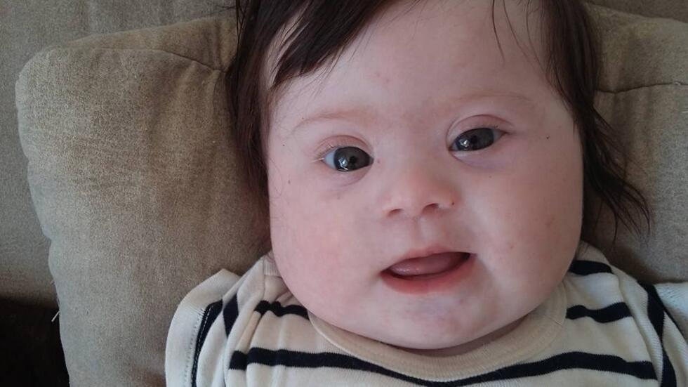 French mother’s Facebook post on her baby's Down syndrome goes viral